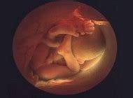 胎宝宝（1-40周）全部发育图 - 家庭日记 - 准妈妈﹌浪漫小屋 - 趣宝网家庭