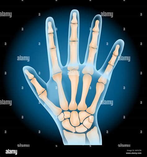 X ray of palm Stock Vector Images - Alamy