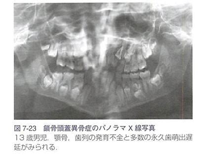 Image result for Alien in Spce