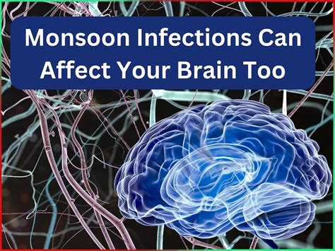 5 Common Monsoon Infections And Their Neurological Manifestations ...