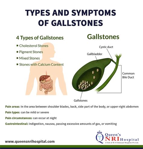 Itchy Rash From Gallbladder at Brenda Ferri blog