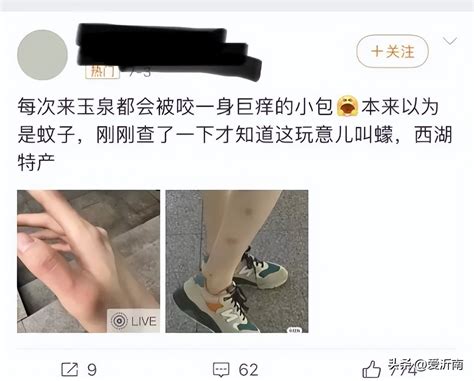 recent! Sudden unexplained itching, redness and swelling on the body, quickly open this article ...