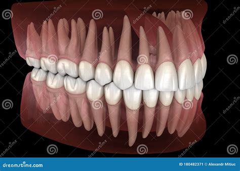 Morphology of Mandibular and Maxillary Human Gum and Teeth. Medically ...