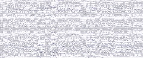 Image result for One Step Beyond Brainwave