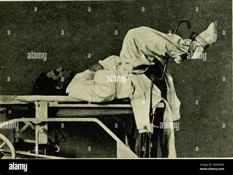 Anesthesia Lithotomy 的图像结果
