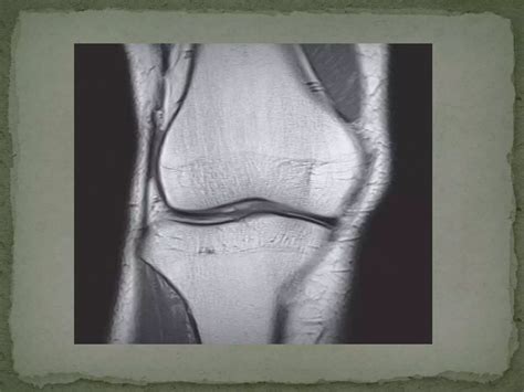 Anatomy and imaging of knee joint | PPTX