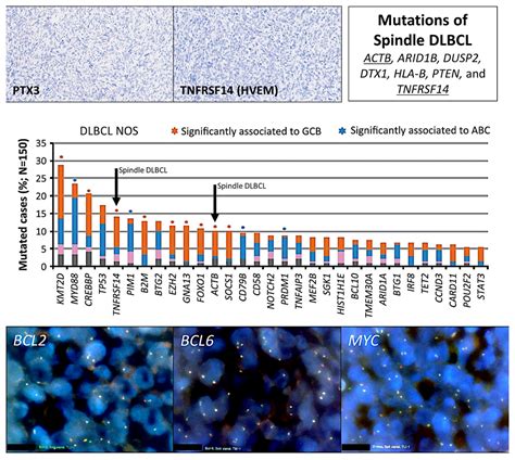 Mutational Profile and Pathological Features of a Case of Interleukin ...