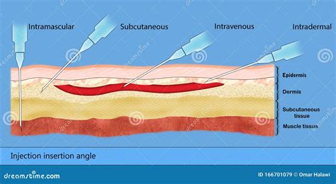 Angle of Injection 的图像结果