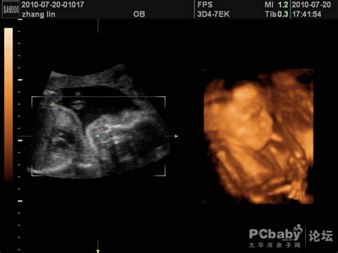 16周胎儿多大,17周胎儿真实图片 - 伤感说说吧
