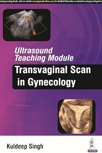 Buy ULTRASOUND TEACHING MODULE:TRANSVAGINAL SCAN IN GYNECOLOGY Book ...