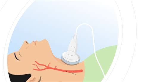 Ultrasound Carotid Doppler in Sonipat | Affordable & Reliable Diagnostics