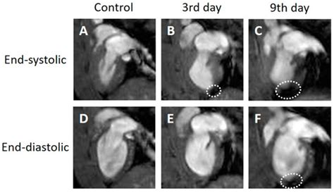 Application of Magnetic Resonance Strain Analysis Using Feature ...