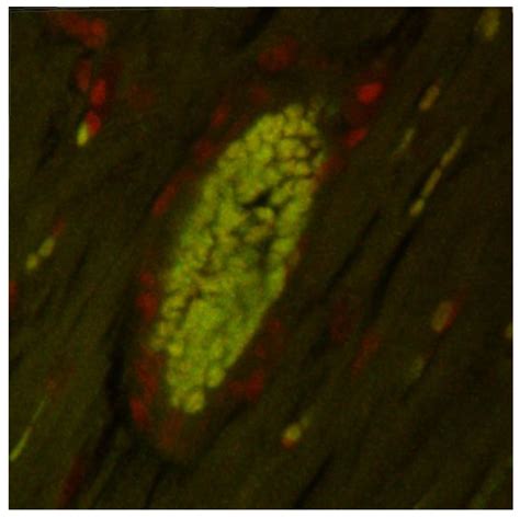 Aliskiren-Loaded Nanoparticles Downregulate (Pro)renin Receptor and ACE ...
