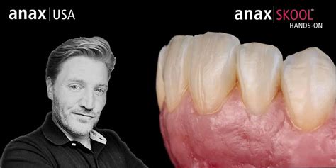 Gingival Form, Texture and Replication in anaxgum w/ Florian Steinheber ...