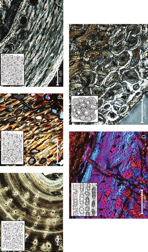 Image result for Flex Bone Matrix