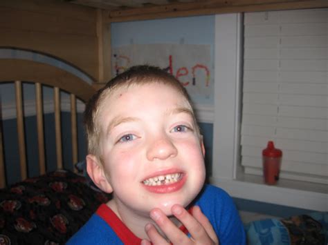 Brothers: Lost Tooth!