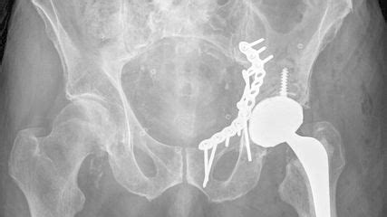 Orthopädie im Bilde - Orthopädie & Traumatologie - Universimed ...