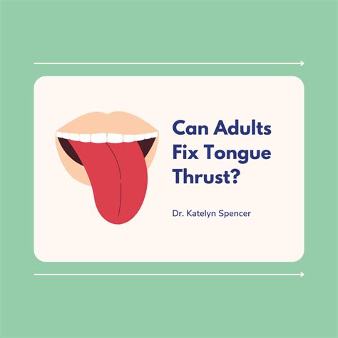 How to Fix Tongue Thrust in Adults | Marvel Myo & Speech