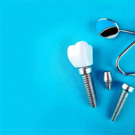 Mantenimiento de implantes dentales: ¿Cómo tener éxito?