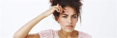 Purging v/s Acne? How to know the Difference!