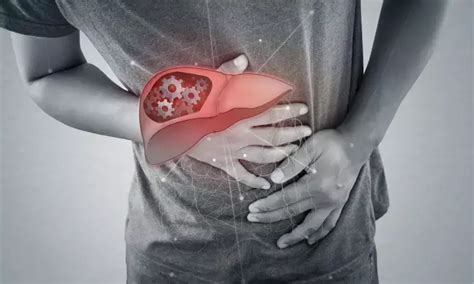 Baclofen effective treatment option for AUD in cirrhosis and alcohol ...