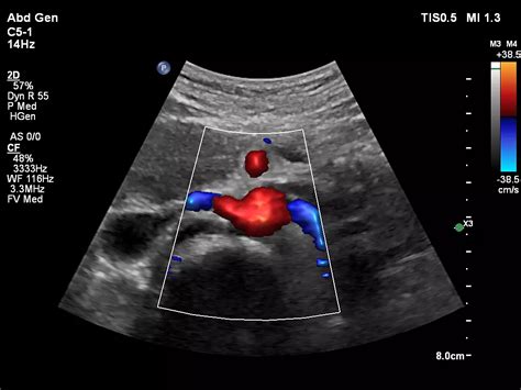 Philips Affiniti 50 ultrasound machine