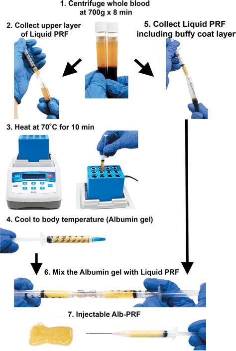 PRF Protocol 的图像结果