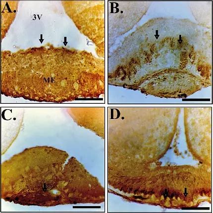 Neurotensin agonist PD 149163 modulates the hypothalamic– pituitary ...