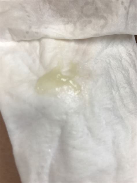 Mucus Plug Discharge