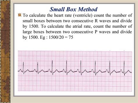 Ecg for Nurses... | PPT