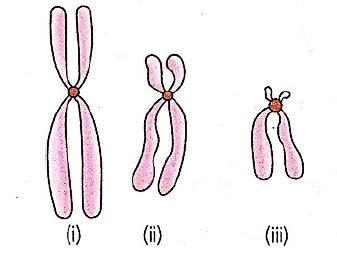 Refer to the given figure Select the option which correctly identifies ...