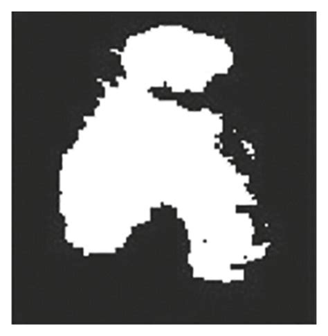 Image result for Image segmentation Methods