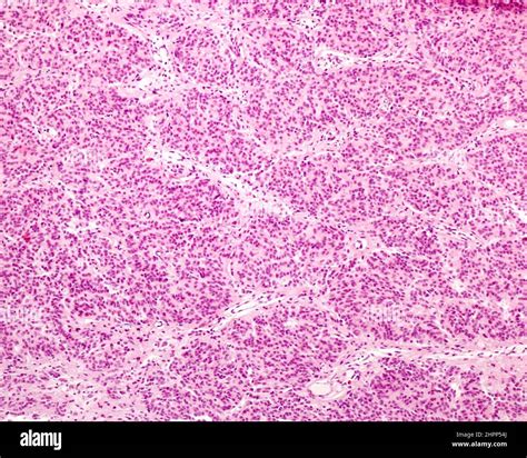 Human pineal gland lobulation, light micrograph Stock Photo - Alamy