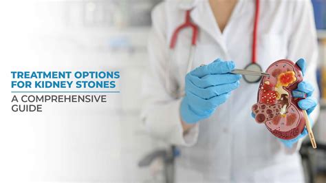 Tackling Kidney Stones: Your Comprehensive Treatment Guide for Relief
