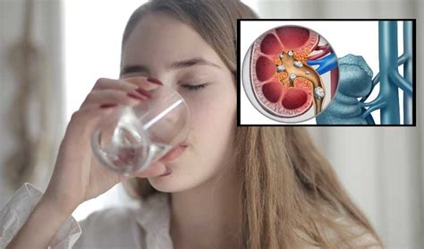 Urination : మూత్రపిండాల ఆరోగ్యం మూత్ర విసర్జనతో చెప్పవచ్చా?... |Kidney ...