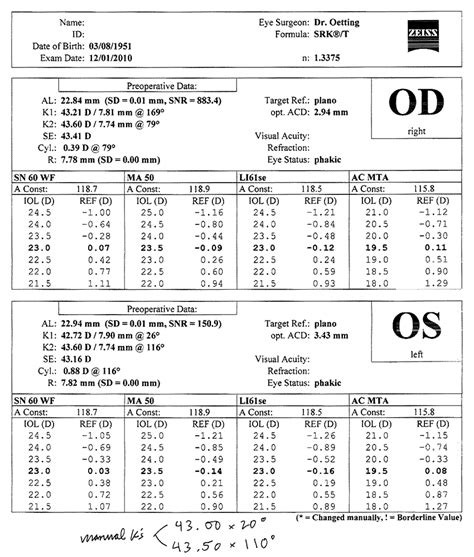 Kuvatulokset haulle plano iol