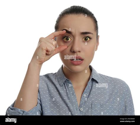 Woman checking her health condition on white background. Yellow eyes as symptom of problems with ...