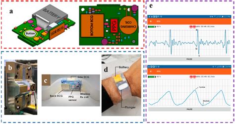 Wearable Continuous Blood Pressure Monitoring Devices Based on Pulse ...