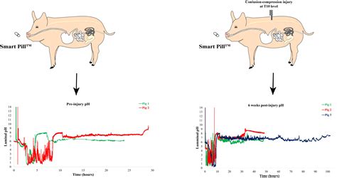SmartPill™ Administration to Assess Gastrointestinal Function after ...
