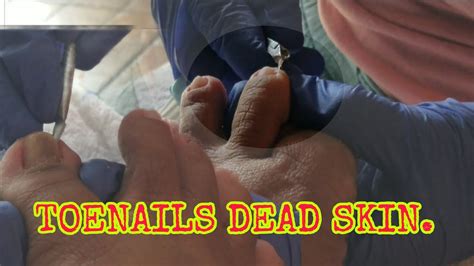 Image result for Clean Toe Nails