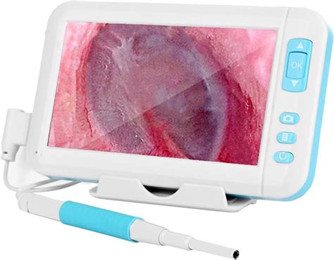 GDFGVBW Digital Otoscope, 3.9mm Lens, Otoscope Camera 1080p Ear Inspect ...