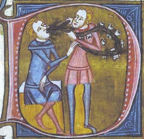 Image result for Medieval Tooth Extraction