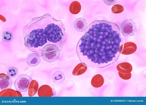 Plasma Cell Leukemia (PCL) - Closeup View 3d Illustration Stock Illustration - Illustration of ...