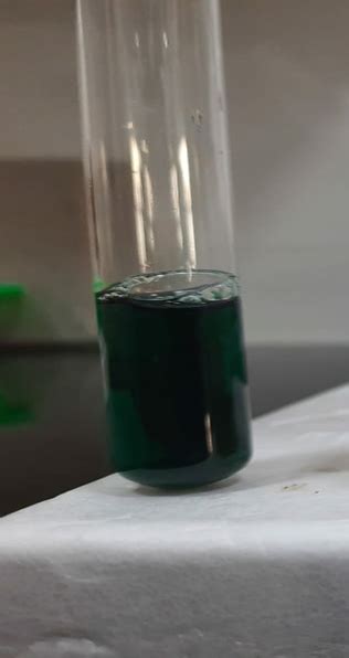 Nephrotic syndrome in a child with alkaptonuria | Pediatric Oncall Journal