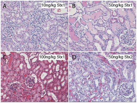 Shiga Toxins and the Pathophysiology of Hemolytic Uremic Syndrome in ...