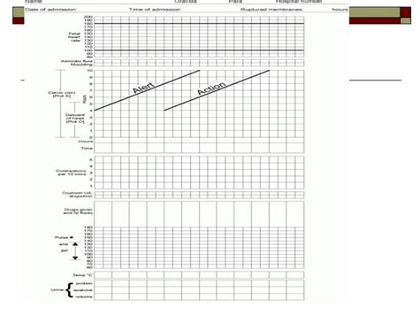 Image result for Partogram Examples