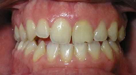 Ortodoncia Borja | Qué podemos hacer por ti