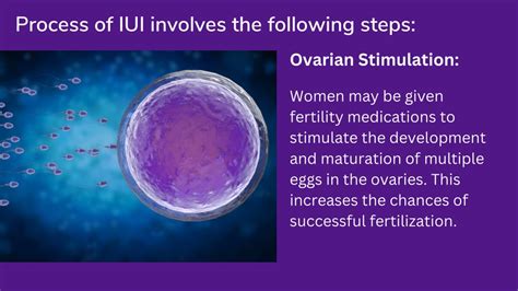 How Is IUI Procedure Done 的图像结果