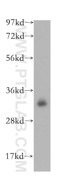 PITPNB antibody (13110-1-AP) | Proteintech