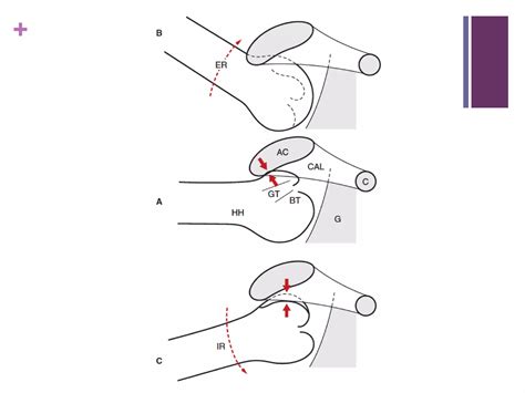 Image result for Scapular Rotation Dysfunction